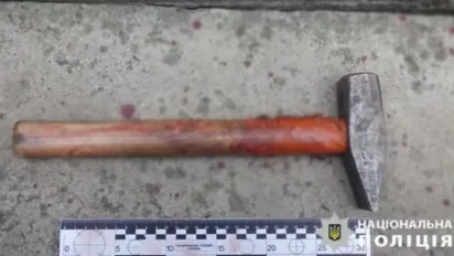 У Києві чоловік напав на рідного брата з молотком - фото