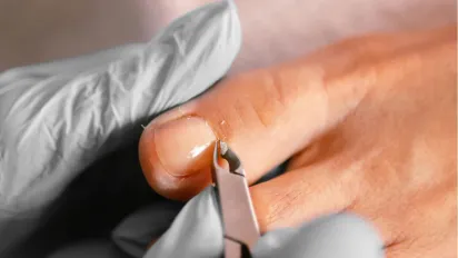 Чи можна обрізати кутикулу: експерт поділився неочікуваною думкою - фото