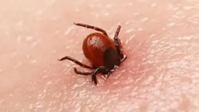  У регіонах України зафіксовано випадки хвороби Лайма після укусів кліщів - фото