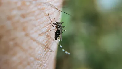 Лікарі радять: як зменшити свербіж після укусу комара - фото