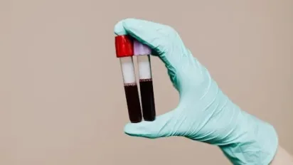 ​​​​​​​Люди з якою групою крові мають найслабший імунітет  - фото