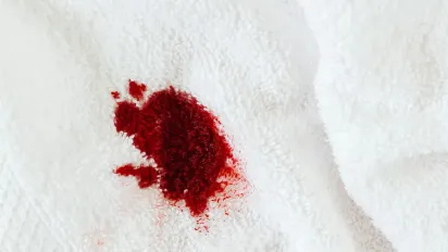 Вивести кров легко: інструкція з порятунку тканин, меблів і навіть килимів - фото