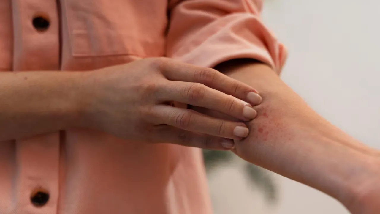 В Україні активізувались небезпечні комахи, що переносять хвороби та викликають алергічні реакції 