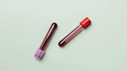 Як видалити плями від крові: надійні методи для різних тканин - фото