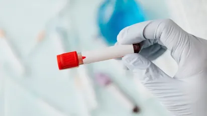 Надавали роками, але тепер не будуть: в Україні частково скасували деякі пільги - фото