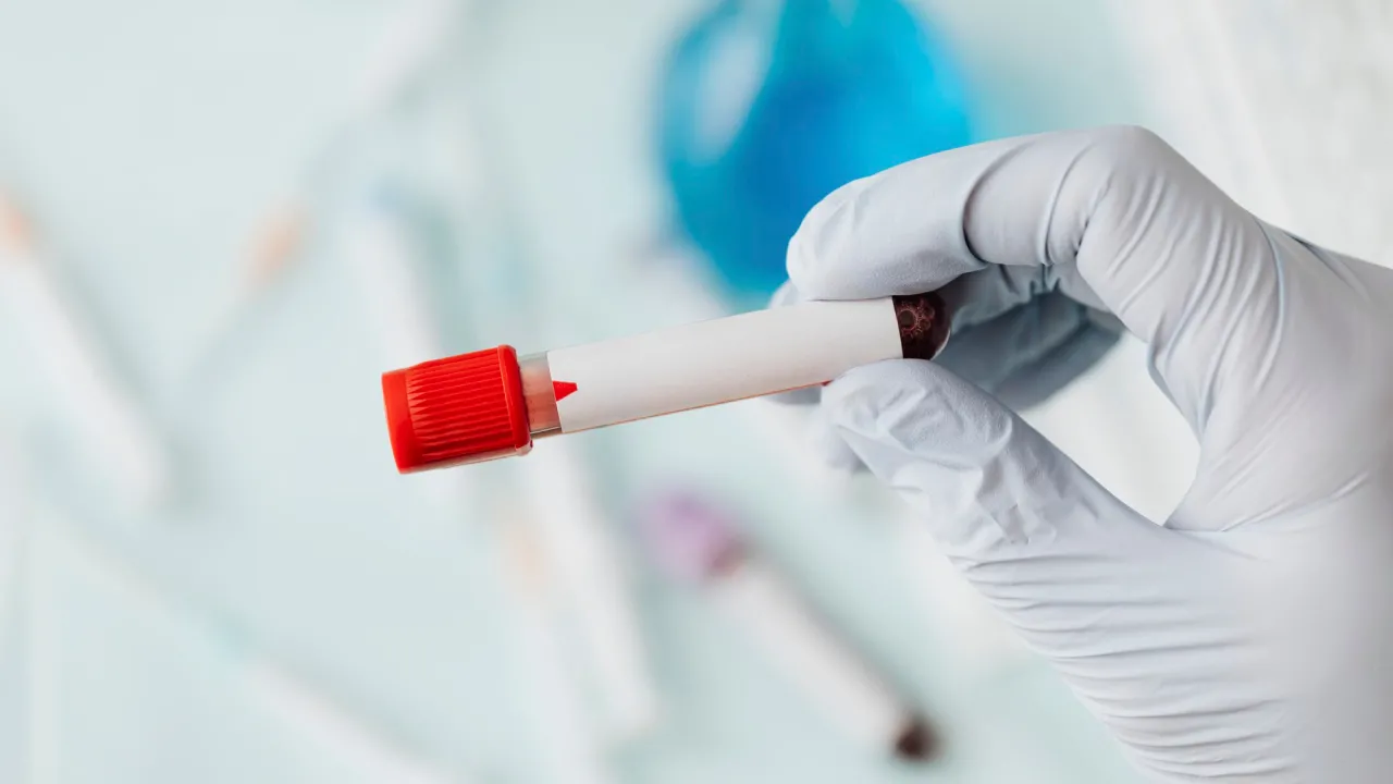 Надавали роками, але тепер не будуть: в Україні частково скасували деякі пільги 