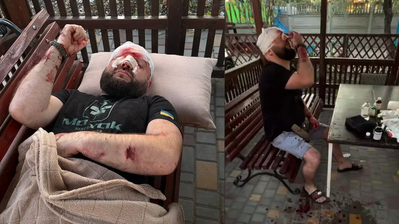 У Затоці чоловік арматурою побив військового після зауваження про російську музику (ВІДЕО) 