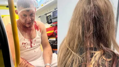 У Польщі побили трьох українців після суперечки через музику біля хостелу - фото