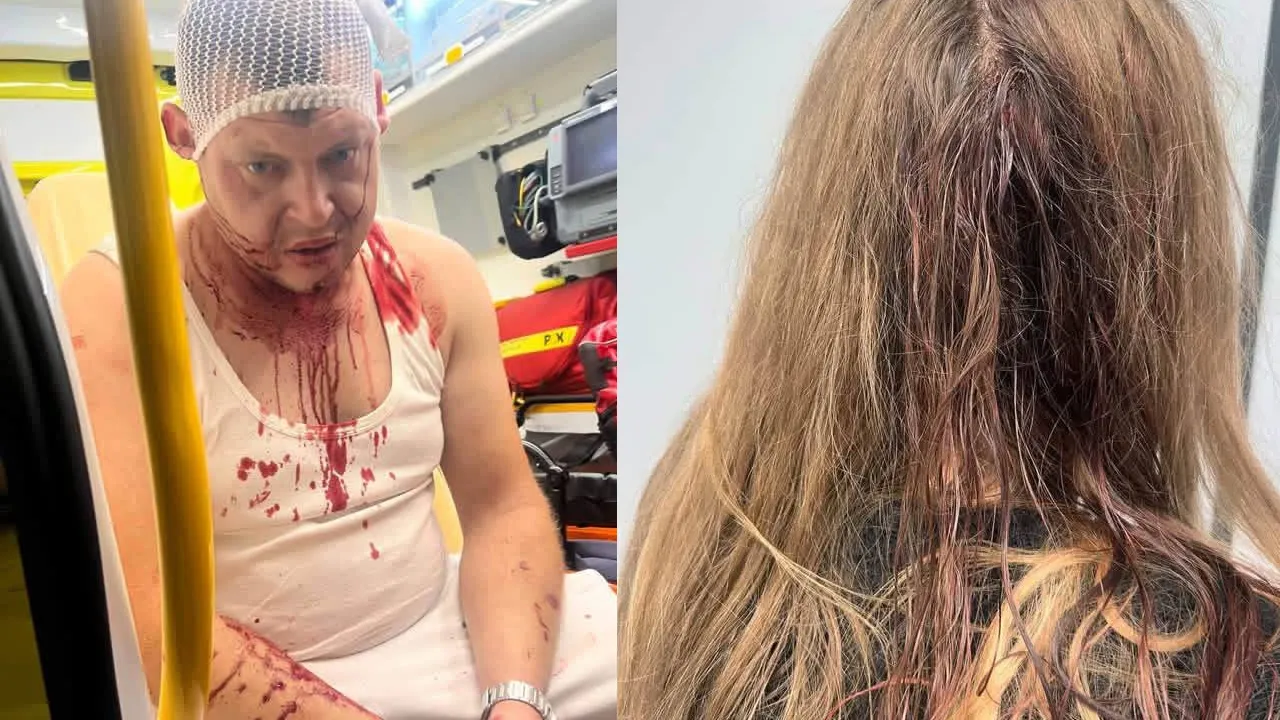 У Польщі побили трьох українців після суперечки через музику біля хостелу 